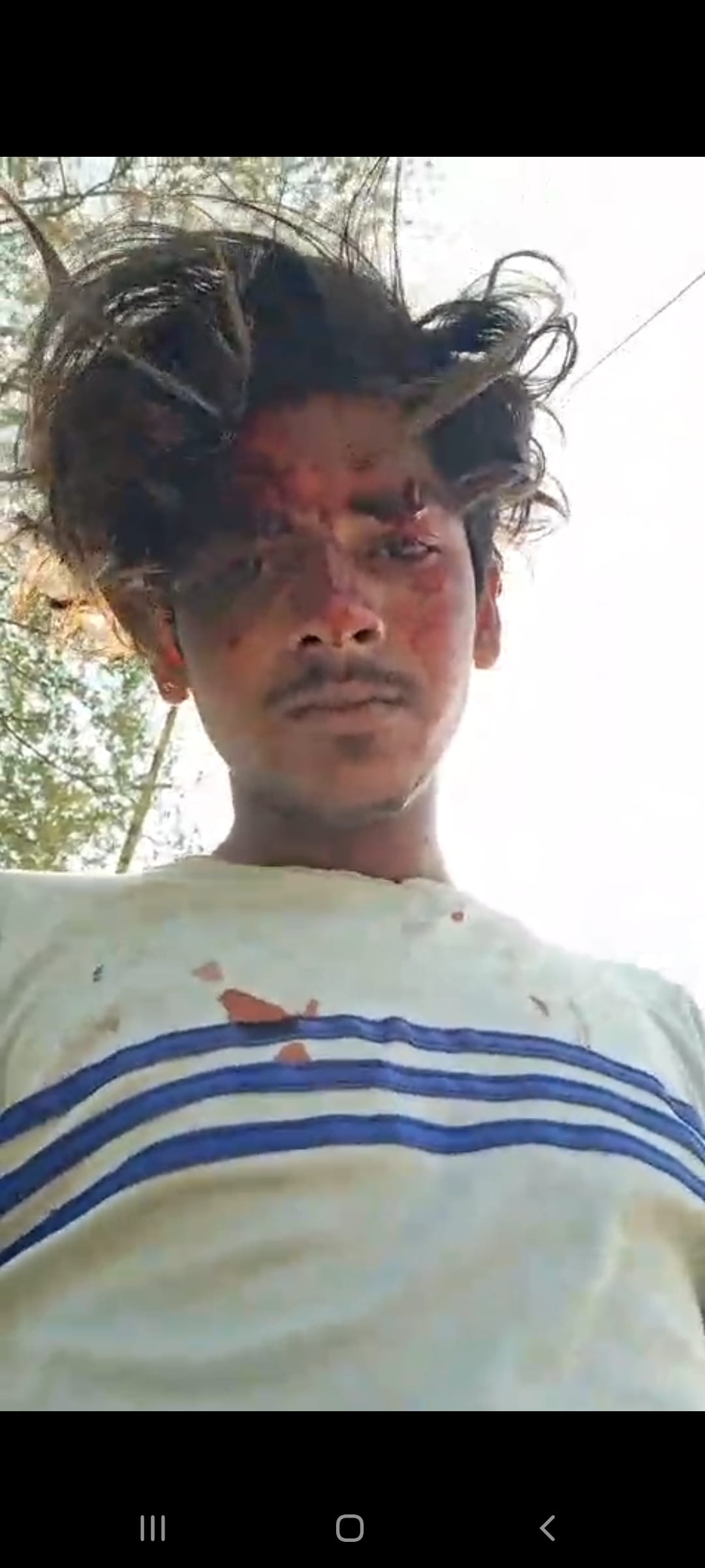 A sanitation worker was beaten up for opposing drinking