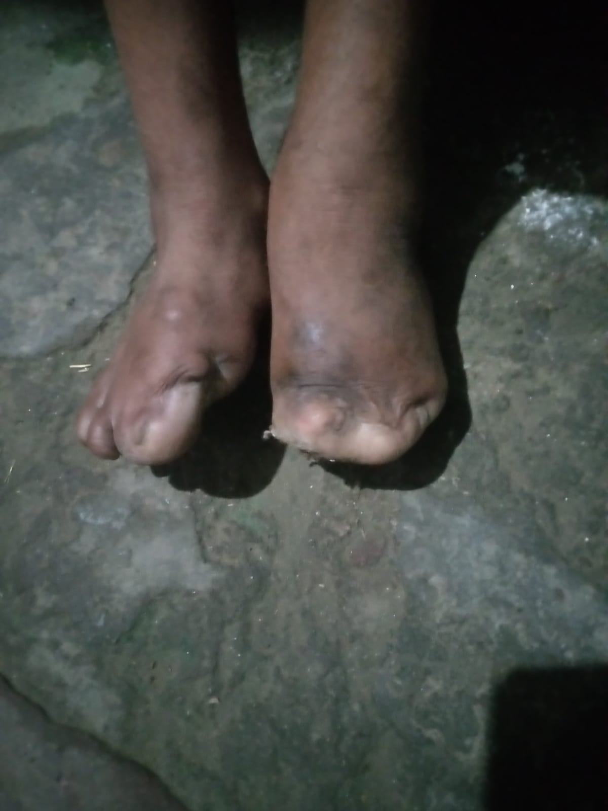 Rats gnaw at the fingers of an innocent child... Poverty has been causing pain for 14 years.