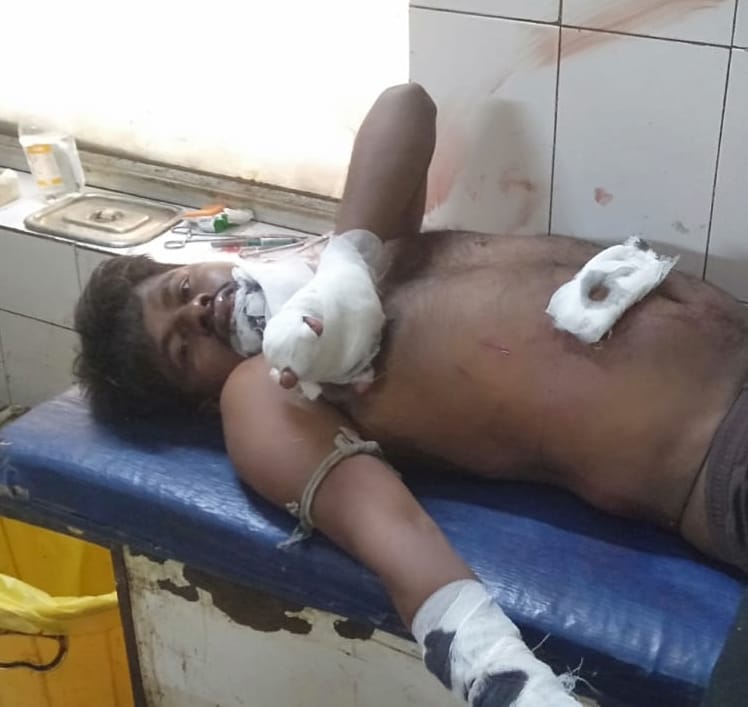 Farmer's condition critical after being attacked by wild animal