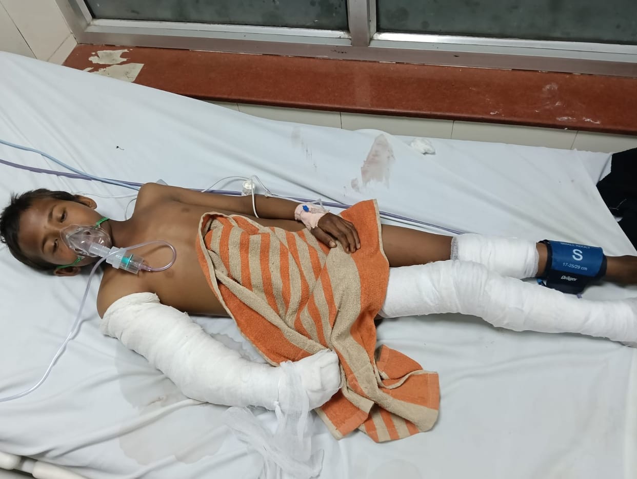In Lucknow Medical College, the innocent child of the Tharu family is fighting for life