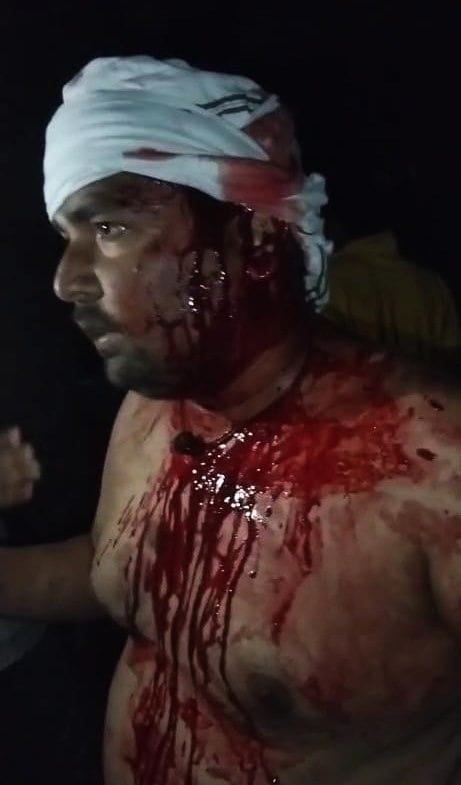 Two groups clashed in Jamuhi village, leaving six people bleeding.