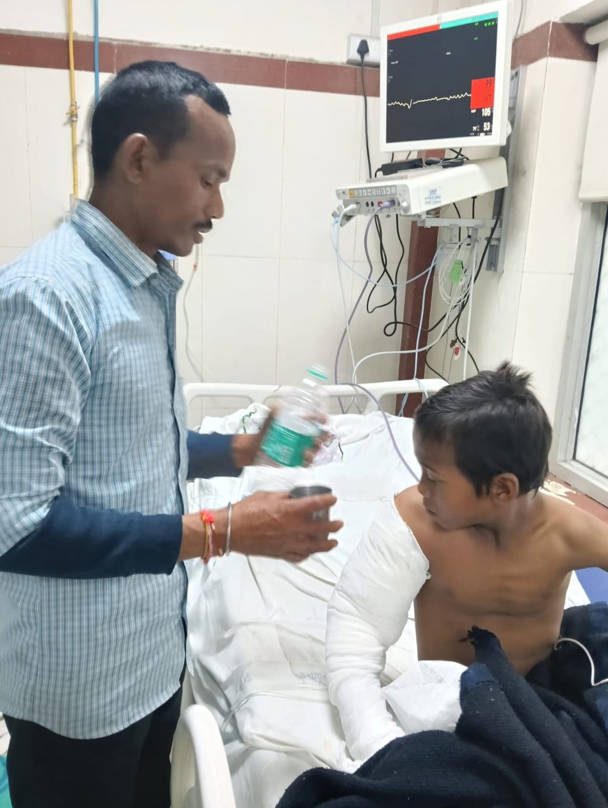 The child who was electrocuted will have his right hand amputated through surgery