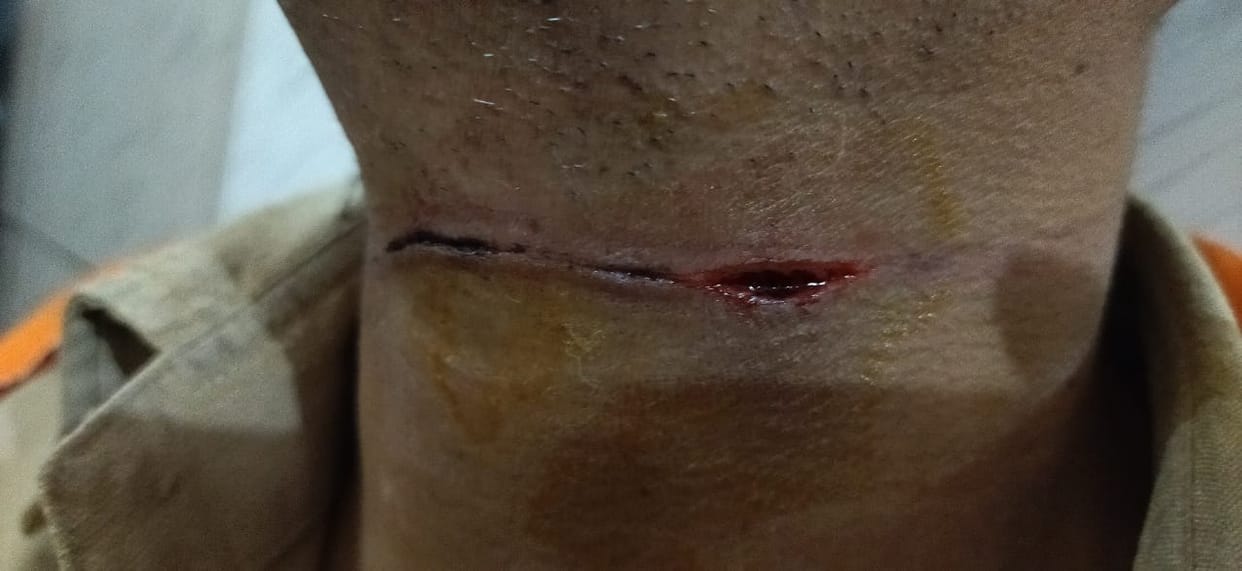A young man was caught in Chinese manjha, suffering a deep cut on his nec