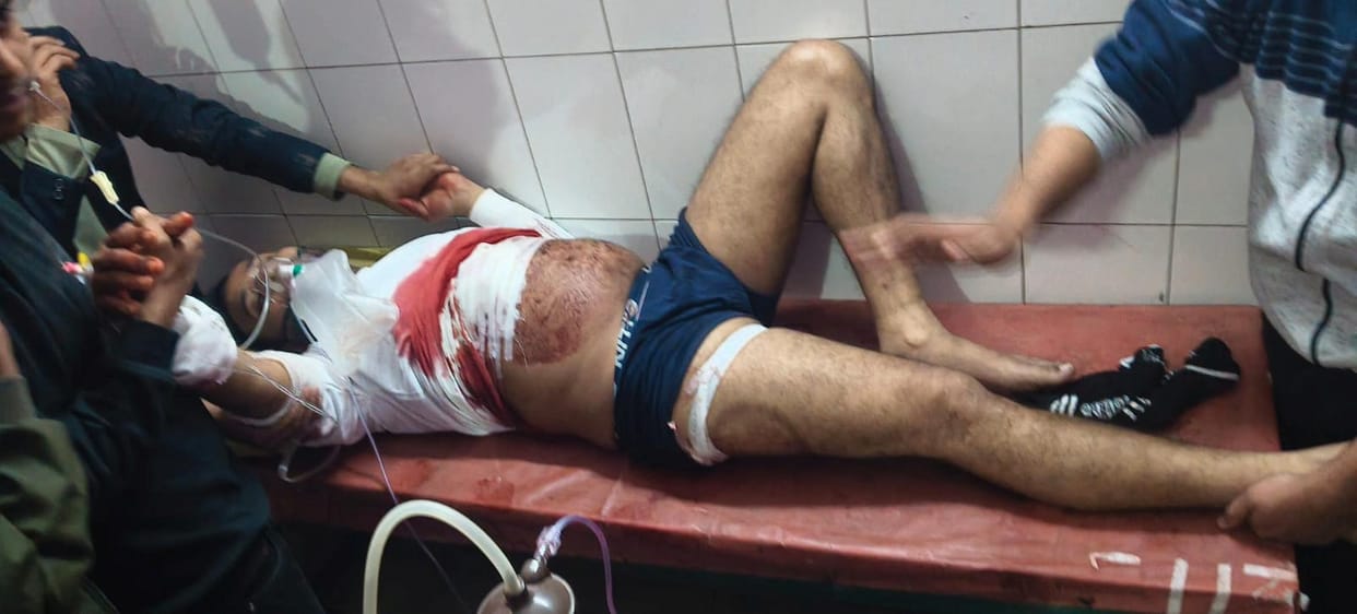 SBI bc shot, referred to Lucknow
