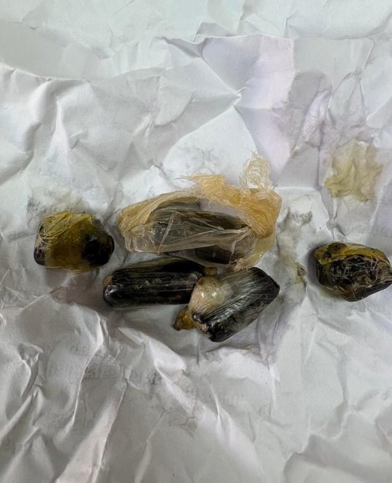 Drug smuggling racket busted in jail, 13.16 grams of sulpha recovered from prisoner's stomach
