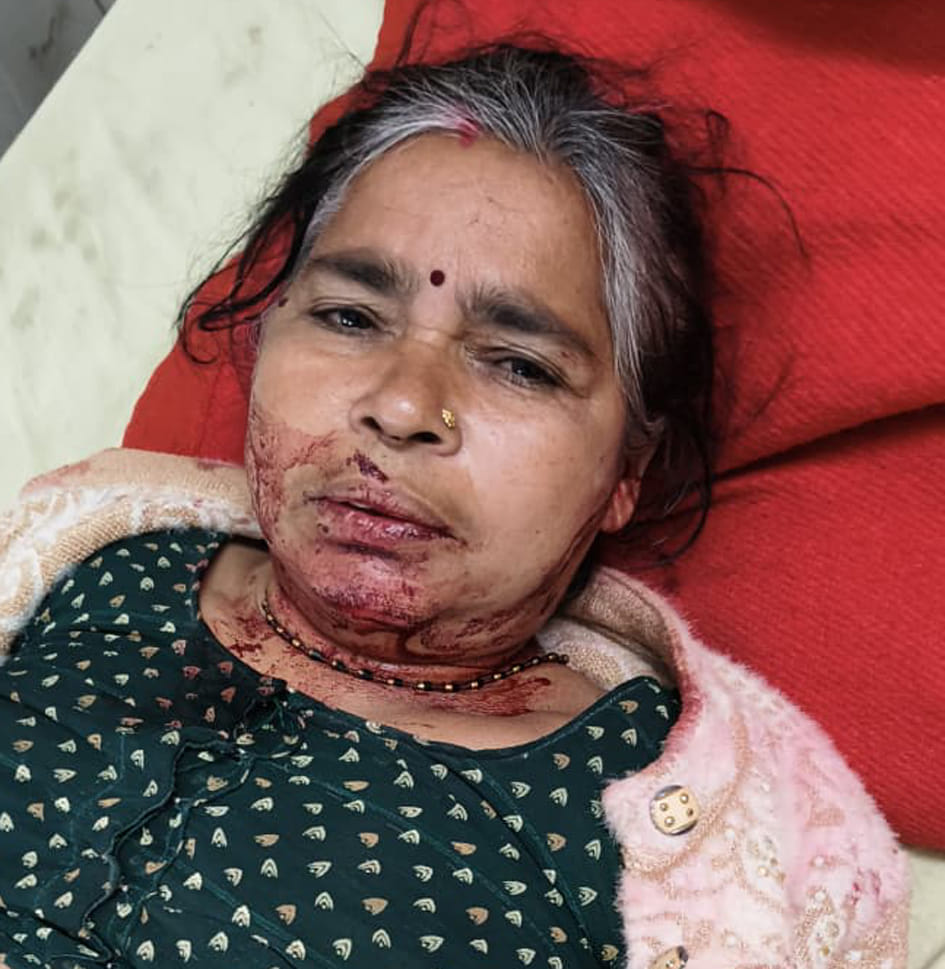 Nine pilgrims travelling in a car were injured when a canter collided with them.