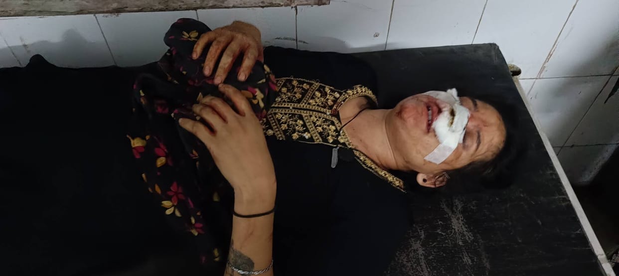 Pet dog collides with bike, bites girl