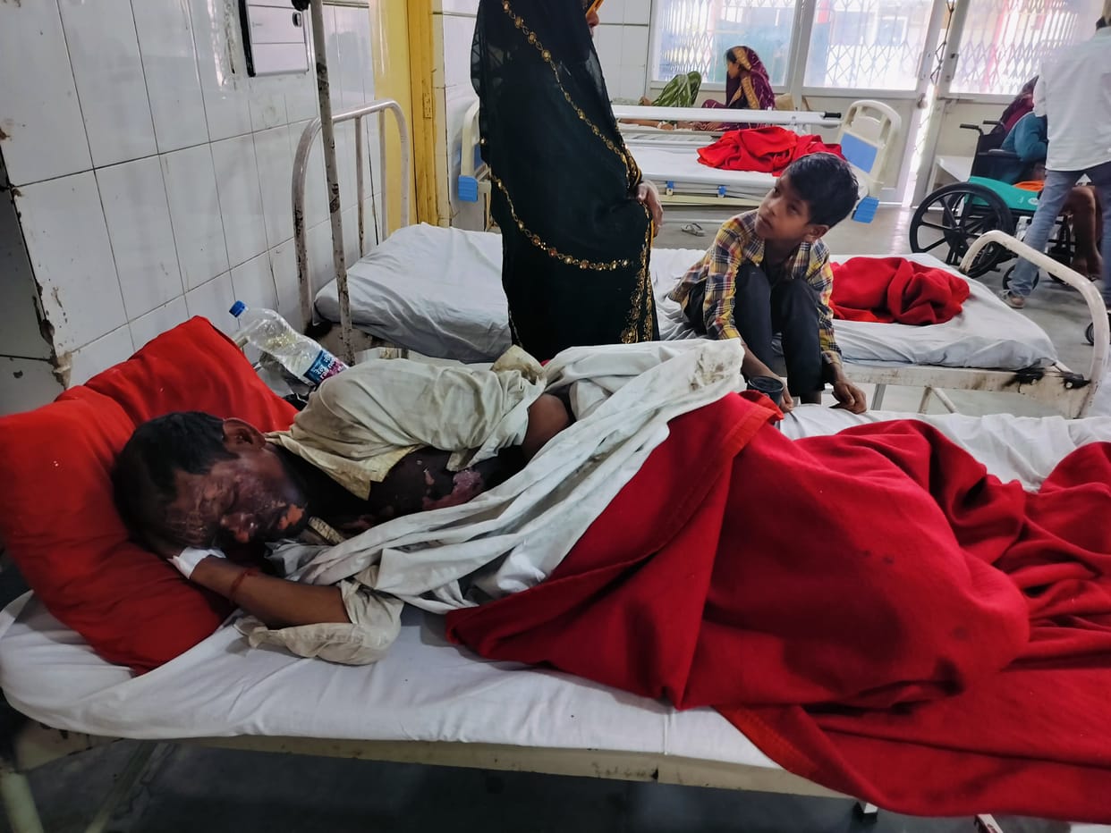 A youth who climbed on the roof of the Ambedkar Express sustained burn injuries and was admitted to hospital.