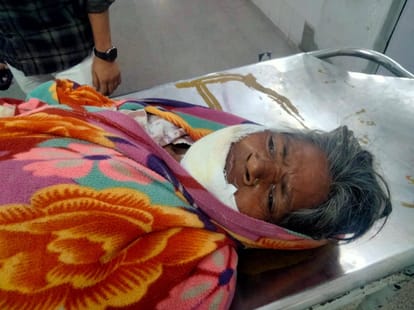 Bahraich News: हिंसक जानवर के हमले में महिला गंभीर Woman seriously injured in attack by violent animal