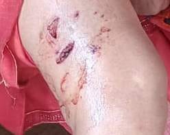The dog scratched both the knees of the woman, the elderly man was also bleeding.