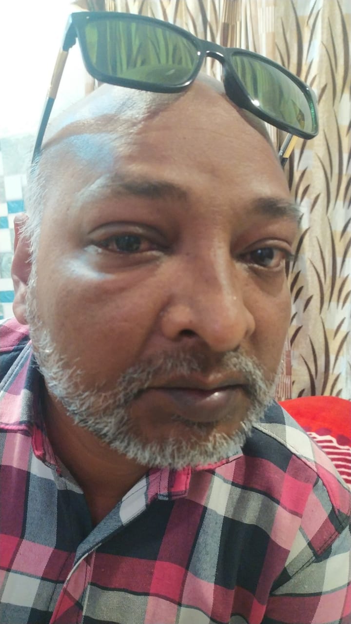 Scooter rider injured by Chinese kite thread hanging in the air, two stitches on the eye