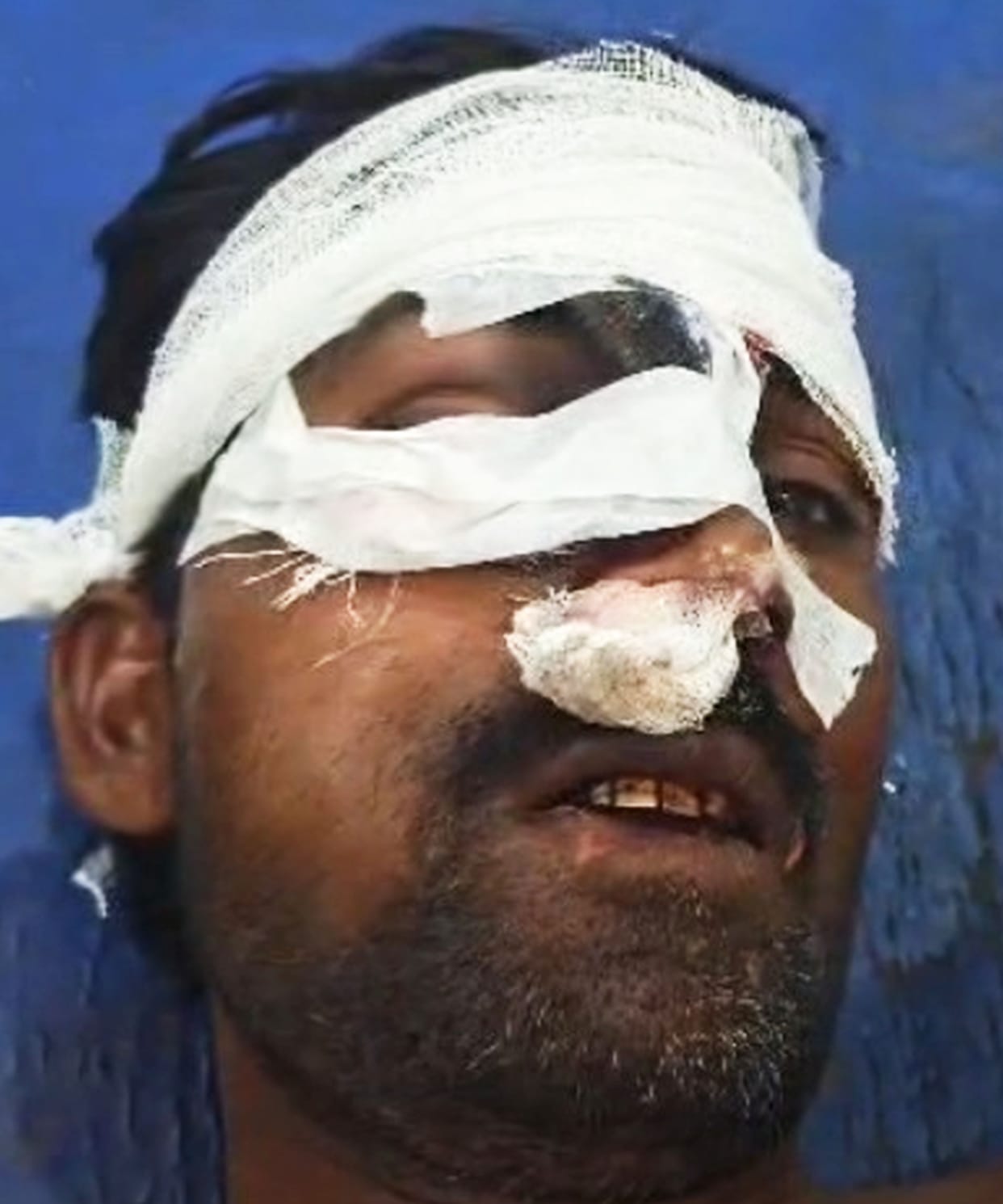 A boy was hit by a bike, angry villagers held the brother and sister hostage.