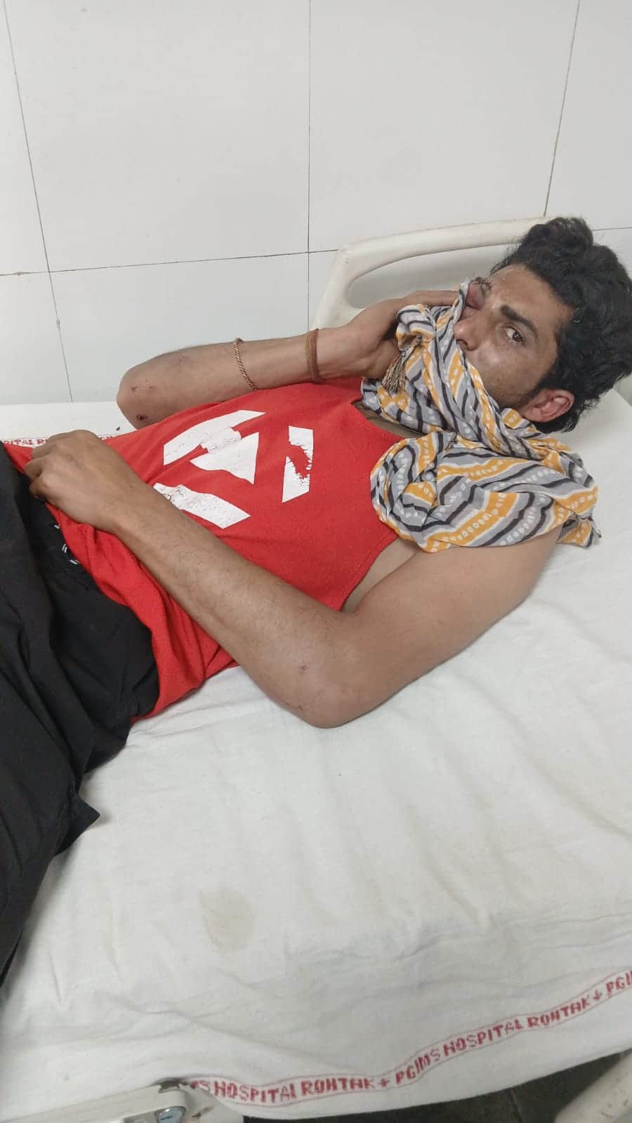 19-झगड़े में आंख पर लगी चोट का इलाज कराने पीजीआई पहुंचे प्रदीप। संवाद