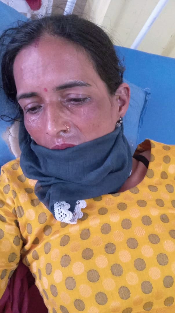 Five injured in collision between two bikes