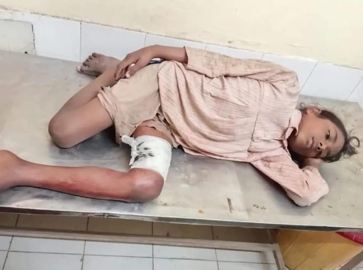 wo girls injured in wild animal attack