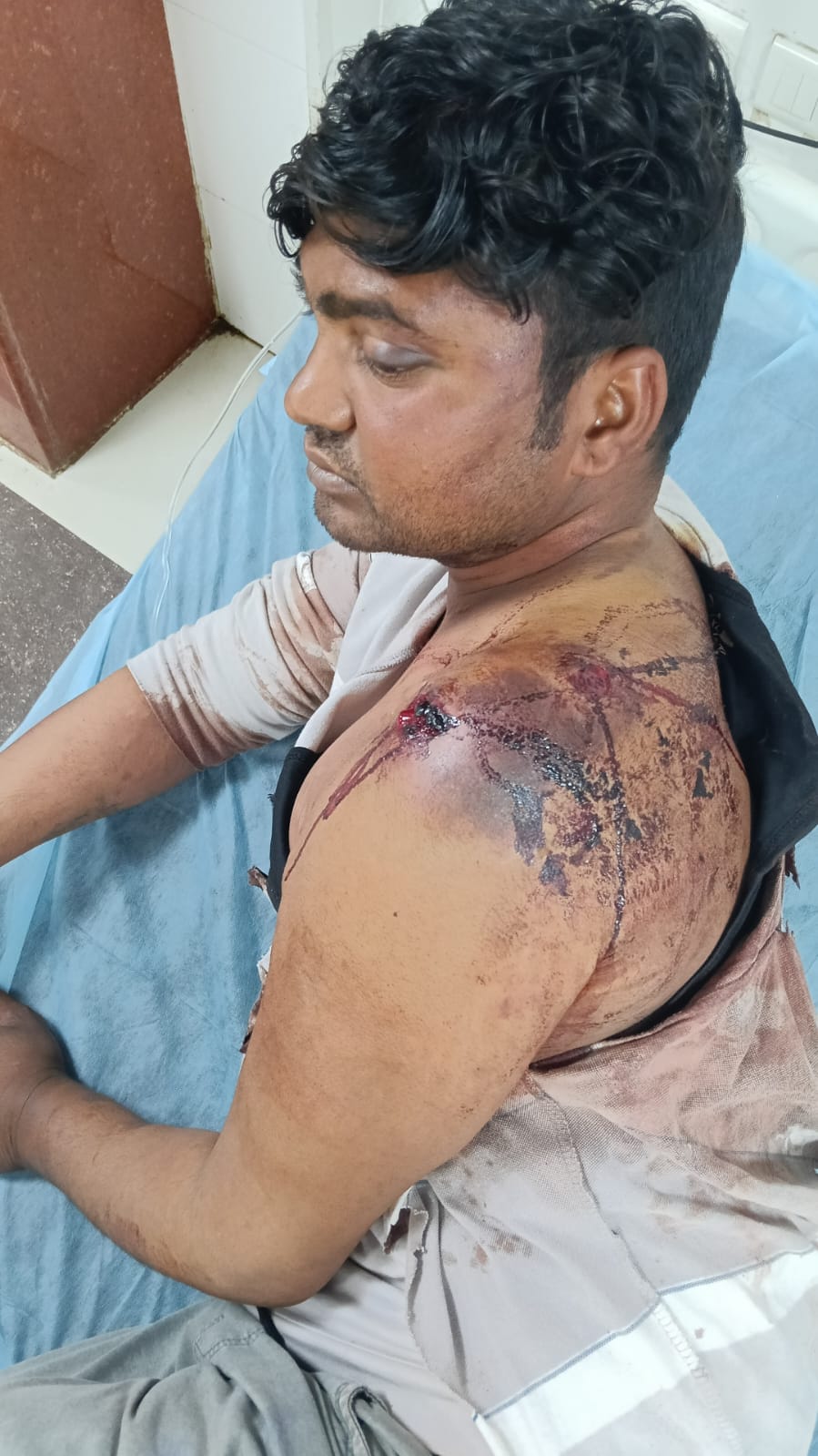 mainpuri news firing two injured
