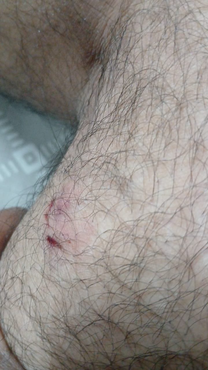 A group of more than 20 monkeys attacked a young man.