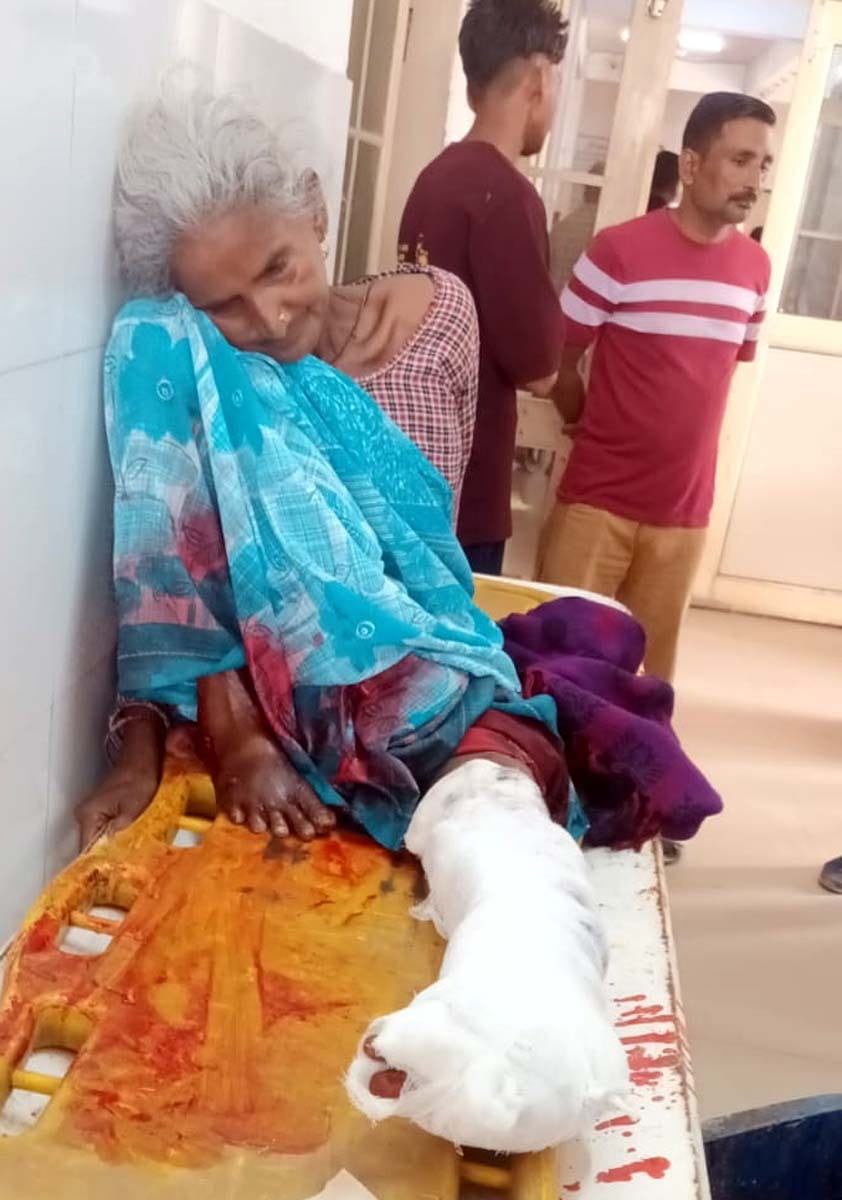 Elderly woman's leg crushed by tanker
