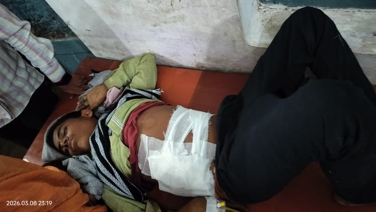 MP: पारिवारिक विवाद के बाद खूनी खेल: रिश्ता हुआ शर्मसार, चाचा ने नाबालिग भतीजे को मारी गोली; इस गांव की घटना