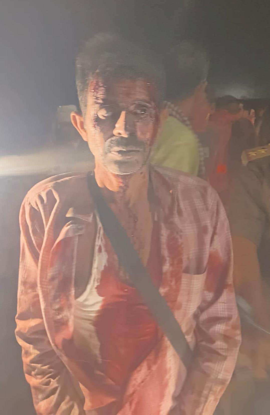 घायल सुफल यादव।