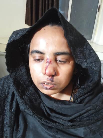Deadly attack on fasting woman in Chatra nose cut off with knife