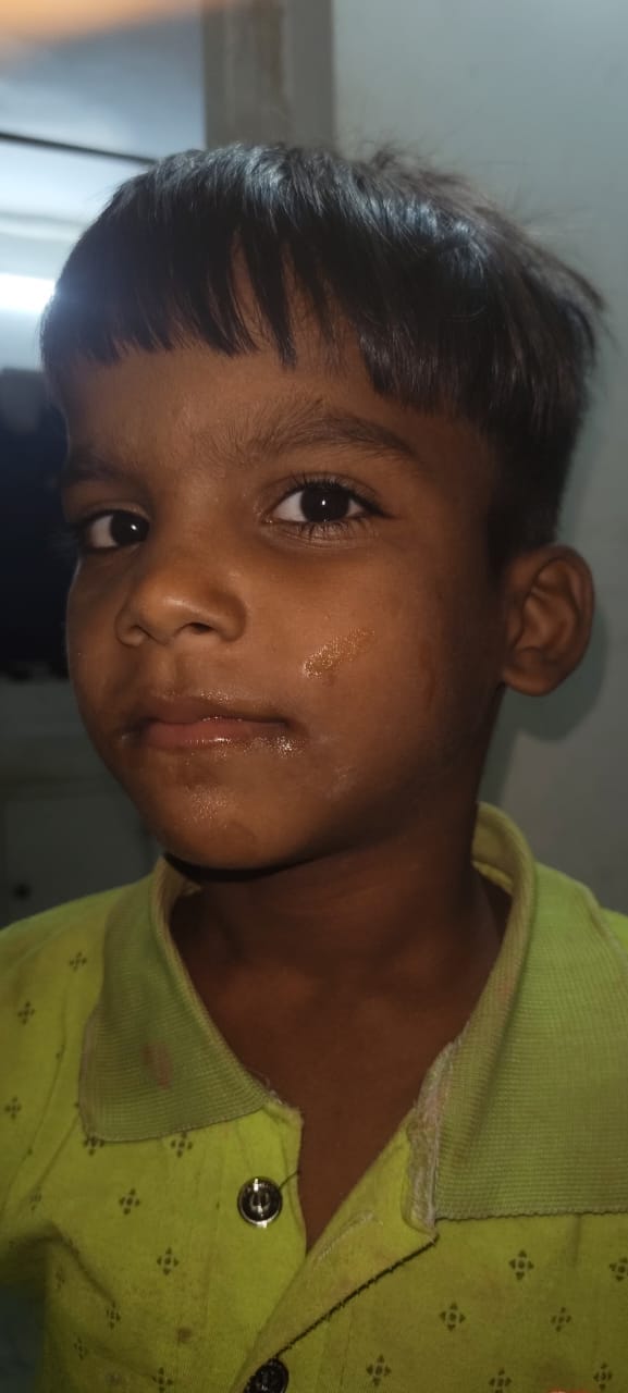 Child dies after being hit by a private bus