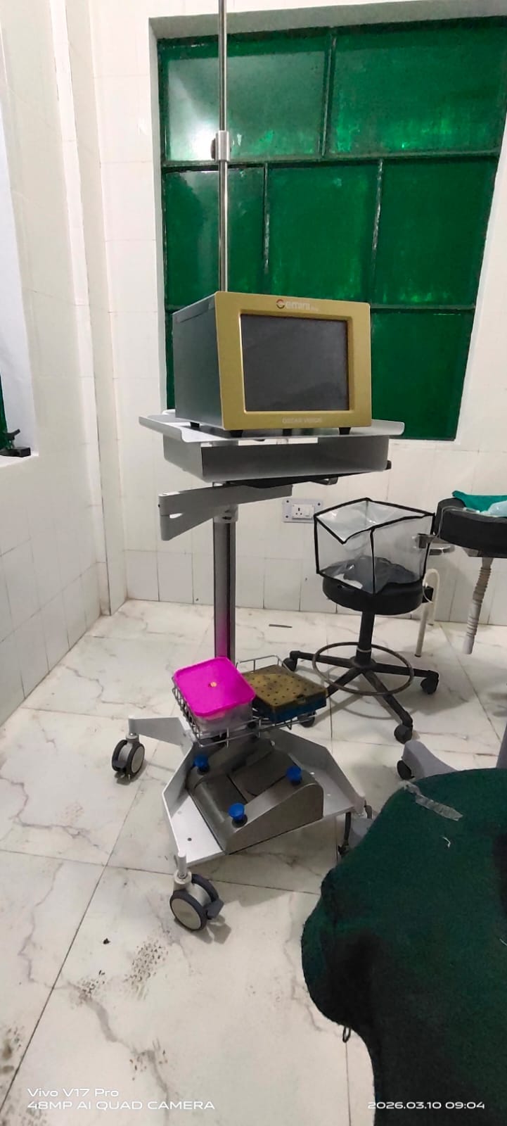 टनकपुर के उप जिला अस्पताल में फेको विधि से मोतियाबिंद के आपरेशन के लिए उपलब्ध मशीन। संवाद