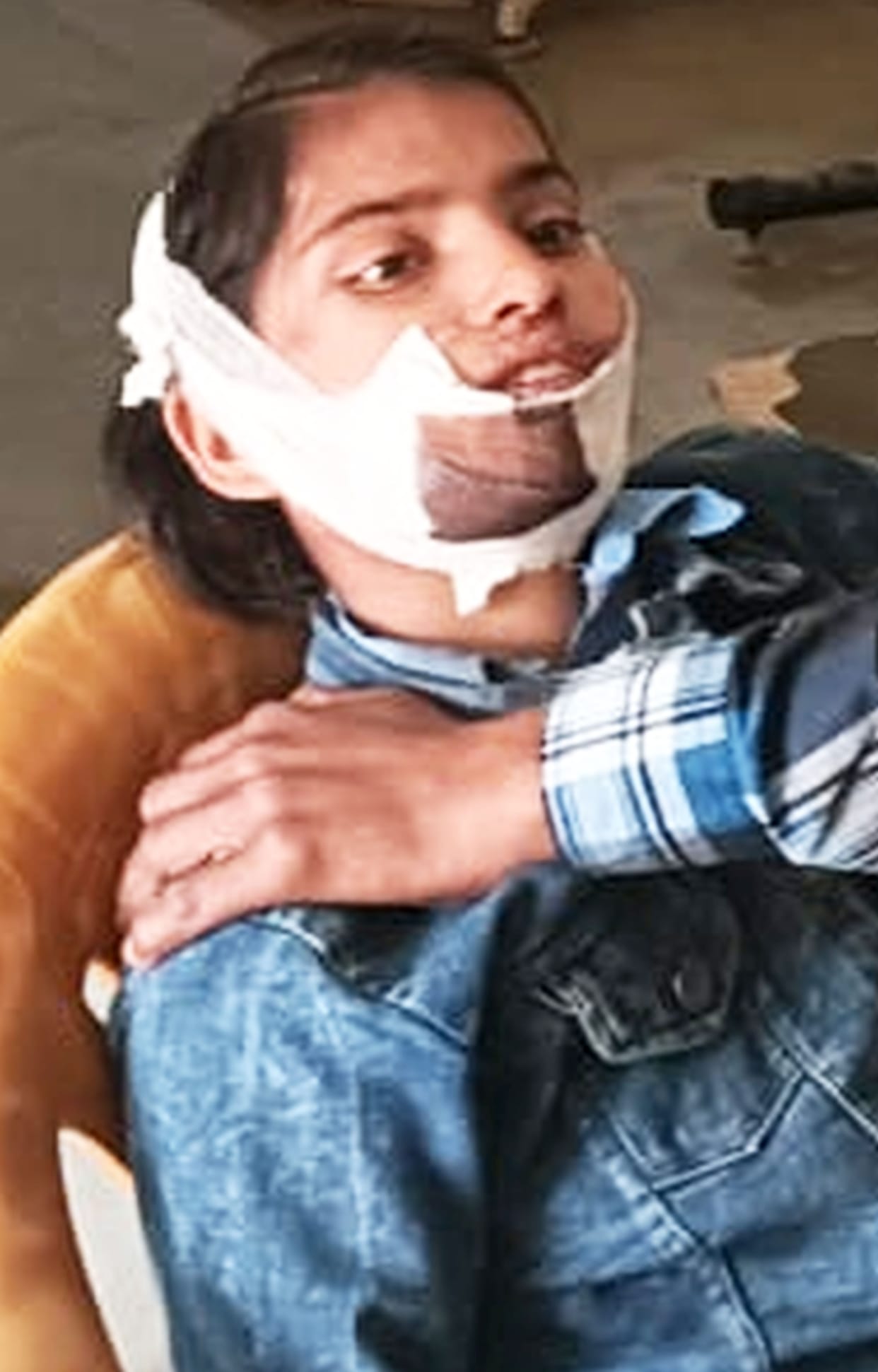 Brother and sister riding a bike injured in a tractor collision