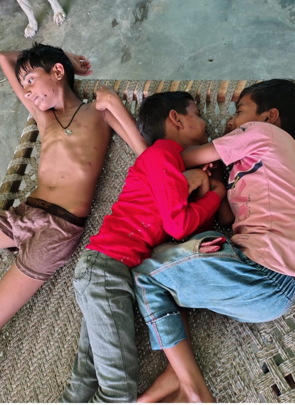 Chicken pox spreads in Samokhar, cots are laid out in every house.