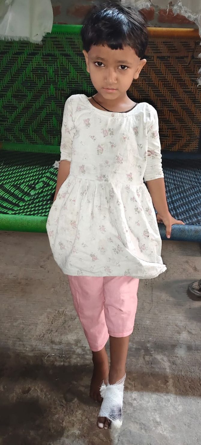 An infant's toe got cut after getting stuck in a broken swing at an Anganwadi centre.