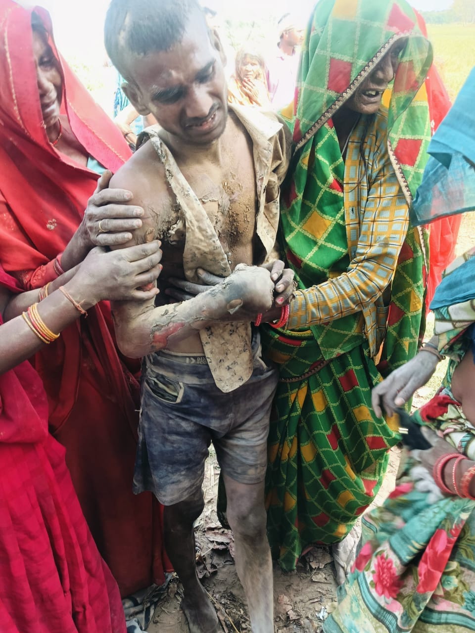 Teenager burnt alive while connecting power lines, cousin suffered burn injuries while trying to save him