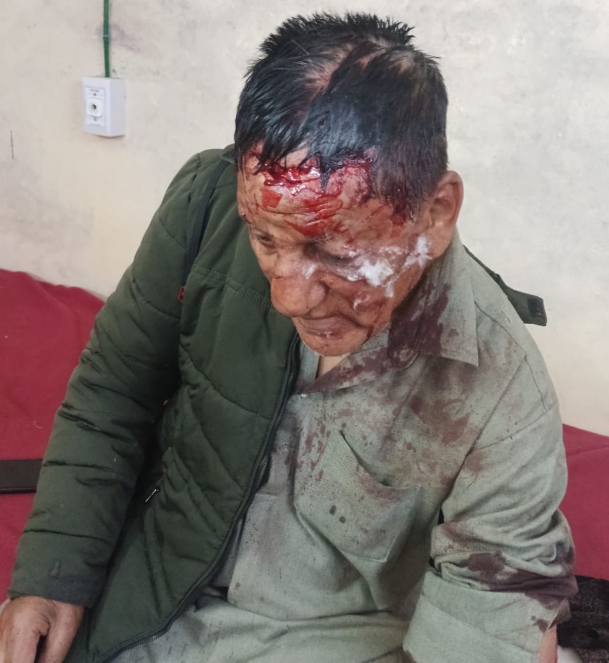 Leopard hiding in cowshed attacks man, referred to IGMC