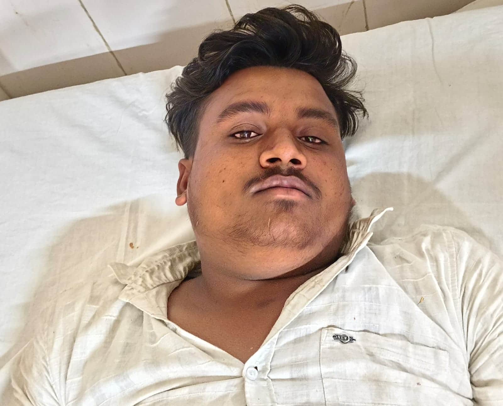 फोटो-18- पुलिस मुठभेड़ में घायल विवेक। संवाद