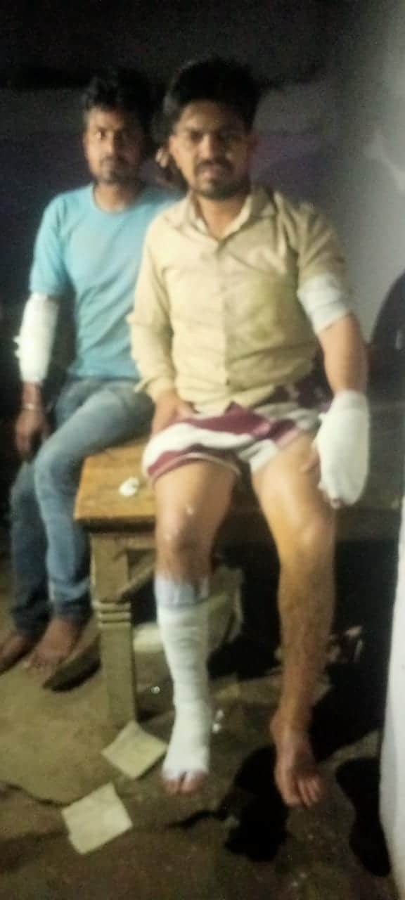 आग से झुलसा युवक। संवाद