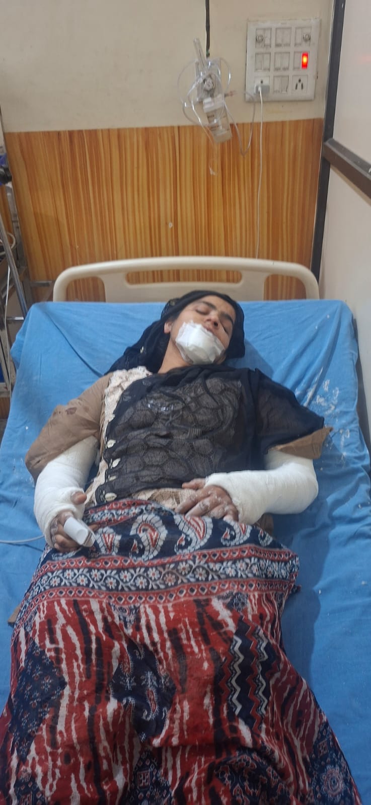 A young woman fell from a rooftop and was injured while trying to escape a monkey attack.