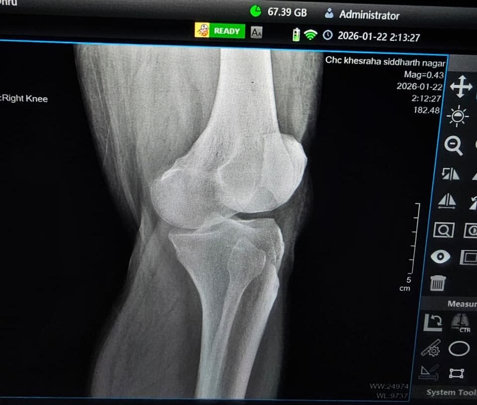 When an MLA went to the hospital with knee pain, the ills of the system came to light.