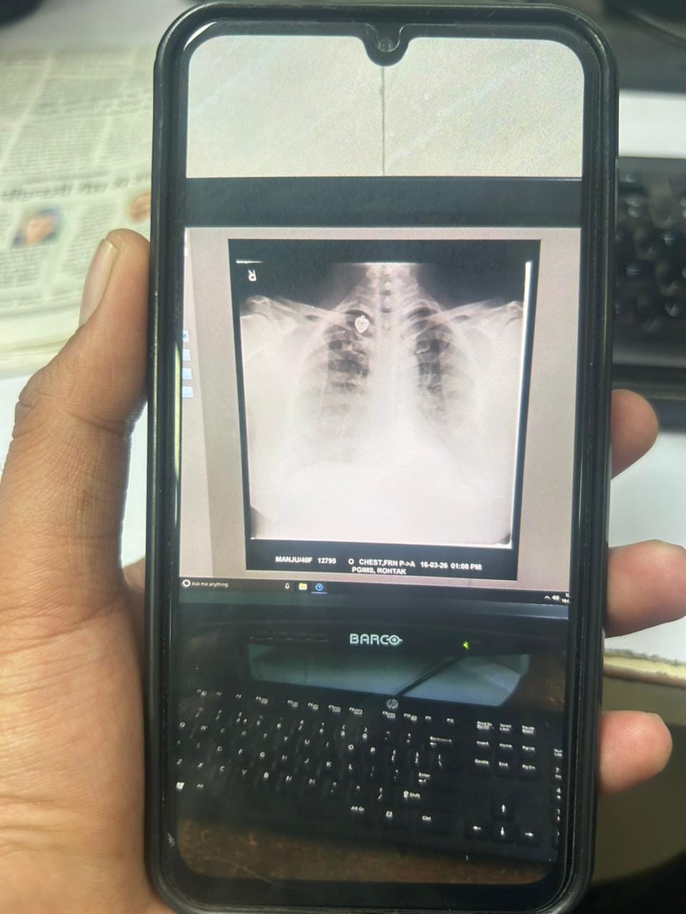 At PGI, X-ray films are being provided directly on mobile phones, and even written reports are not being issued.