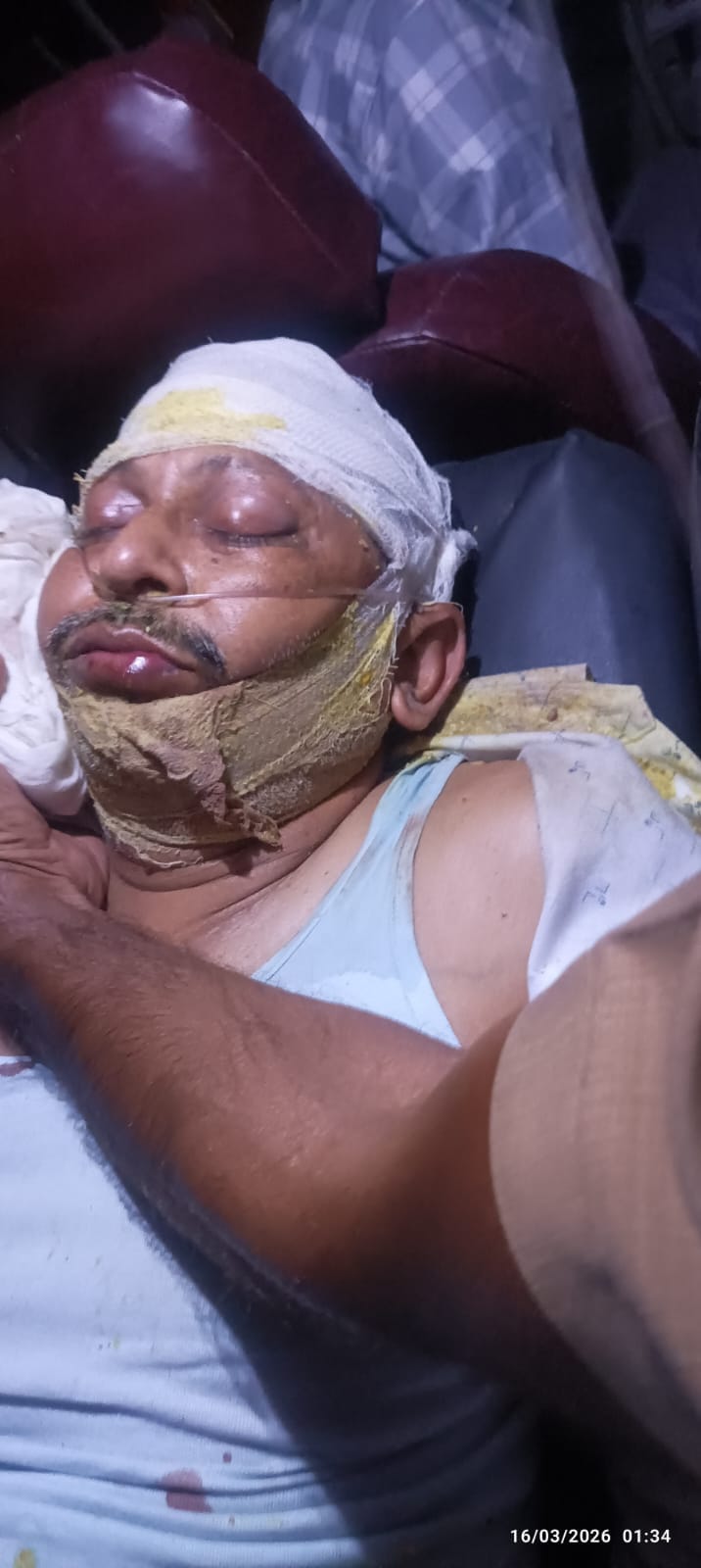 DM's orderly hit by speeding Thar, condition critical