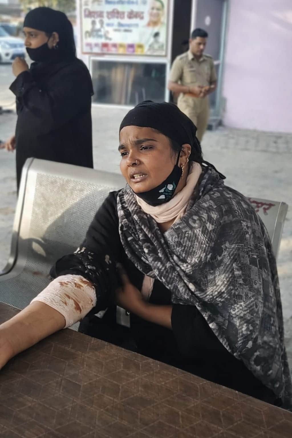 तेजाब से झुलसी महिला। संवाद