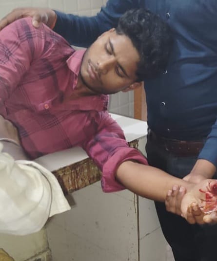 Young man's finger cut off by oil machine