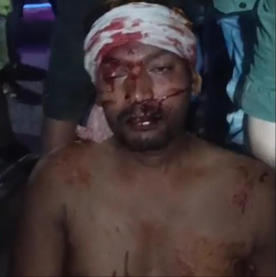 A young man was hit on the head with a rod over a minor dispute, his condition is critical.
