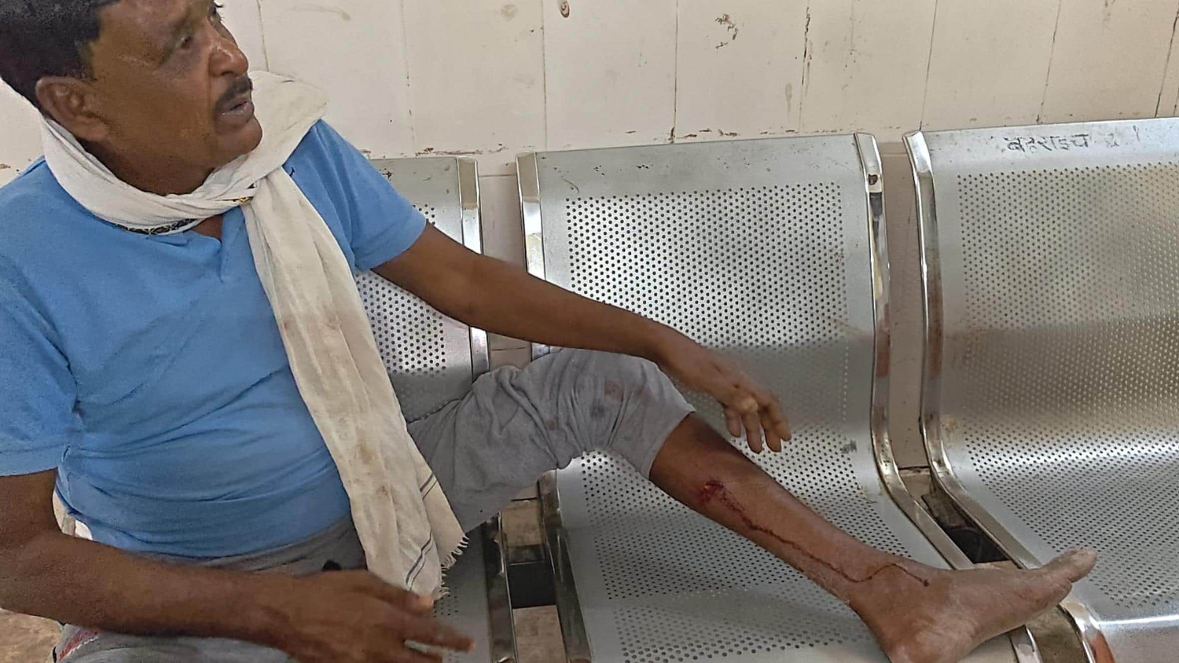 तेंदुए के हमले में घायल ओम प्रकाश।