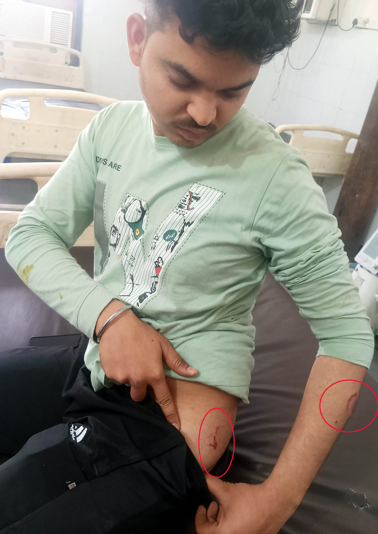In a property dispute, the young man was bitten by his sister-in-law and beaten by his brother.