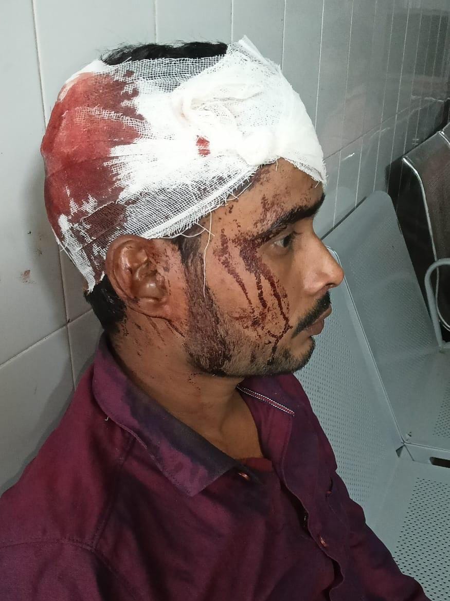 A young man was robbed and his head was broken when he protested