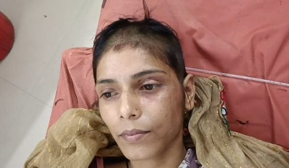 He held his wife hostage, poured petrol in her eyes, and shaved her head.