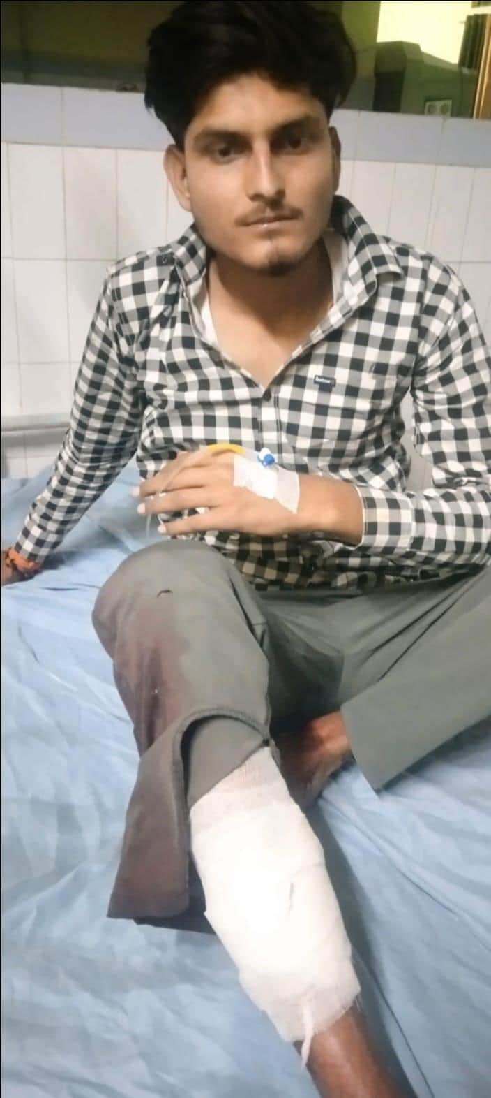 मुठभेड़ में घायल बदमाश। पुलिस विभाग