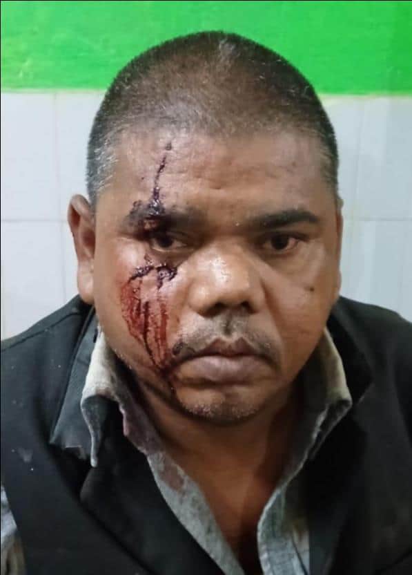 सड़क हादसा-घायल राकेश कुमार। स्रोत-संवाद