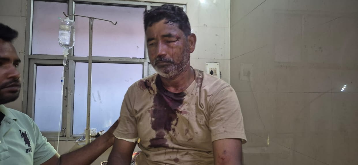 A young man peeling sugarcane was attacked by a tiger and injured