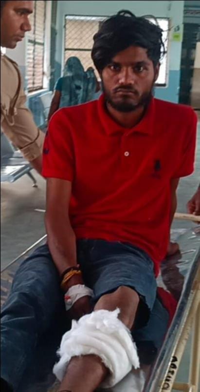 Robbery accused injured in encounter, fellow teenager also arrested