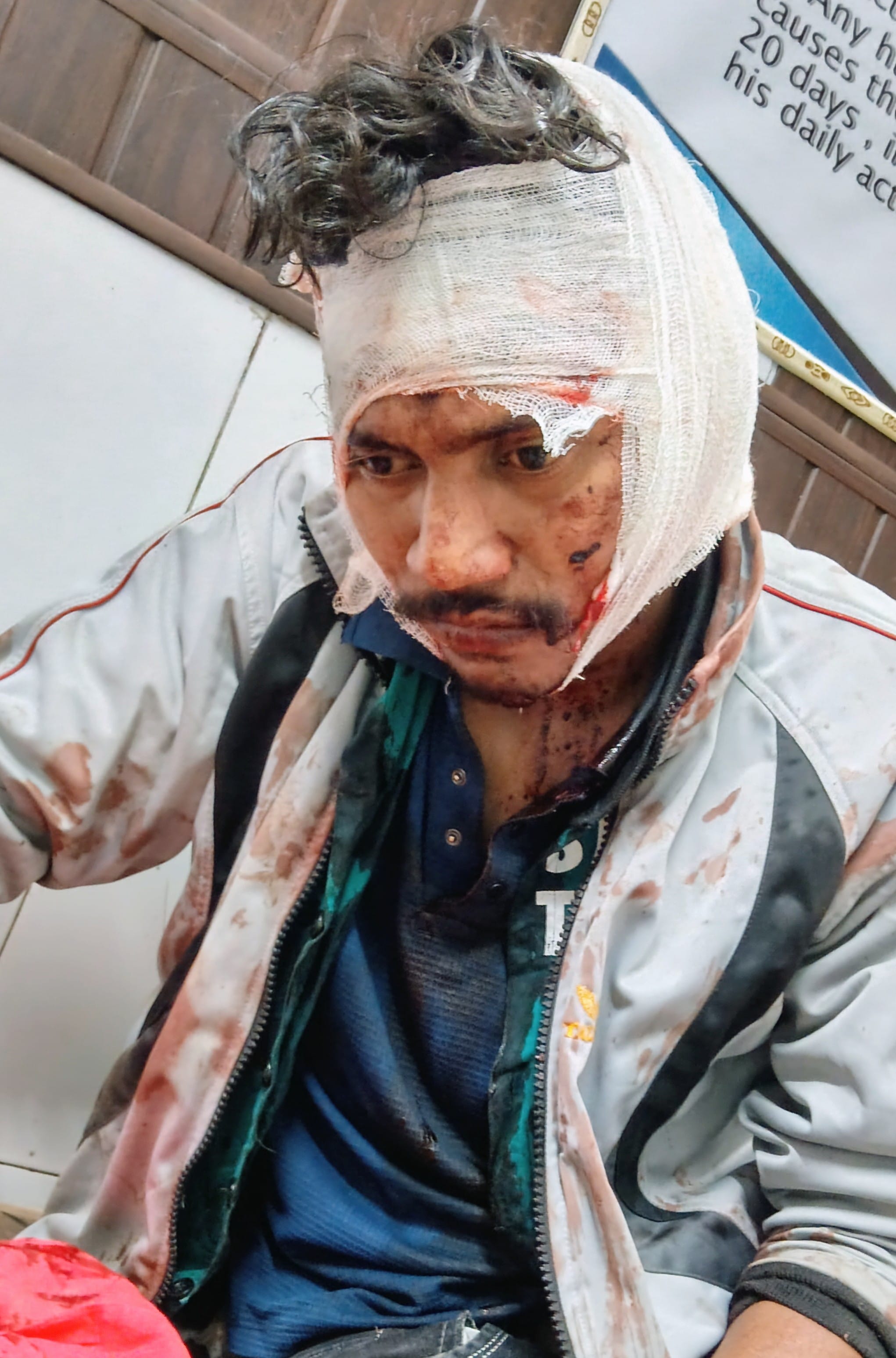 Three injured in a fight in Kishanpur Birana